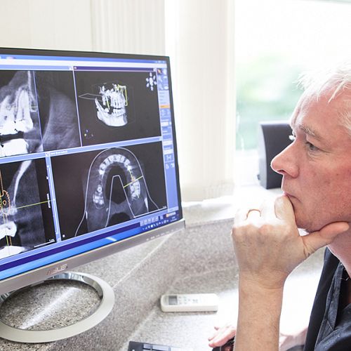 Dental CT Scan